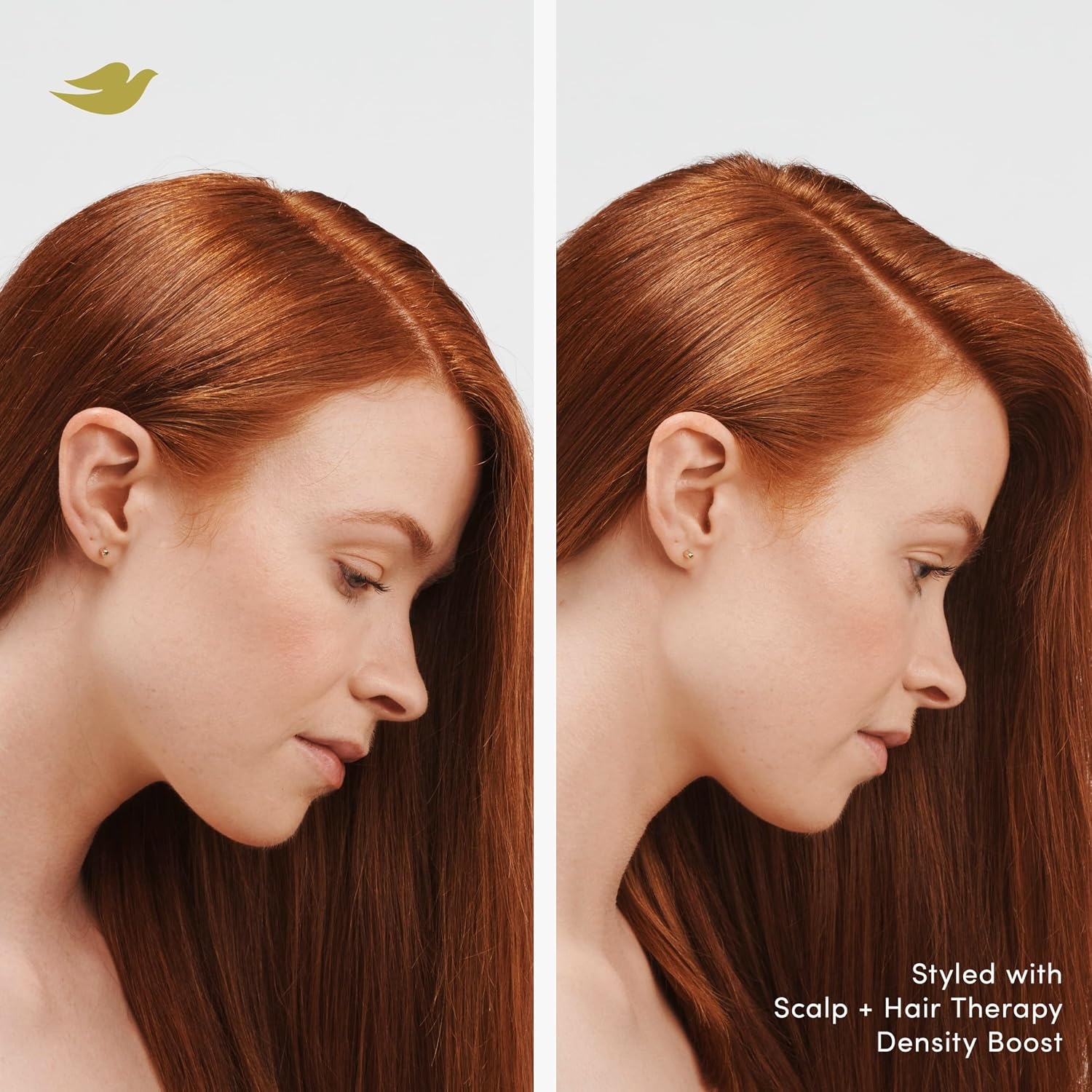 image:imageDove Density Boost Hydrating Conditioner Scalp Therapy for Dry Hair with Vitamin B3 Zinc and 0 Sulfates 925 oz925 Fl Oz Pack of 1